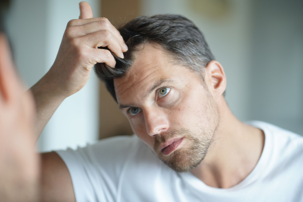 man concerned about hair loss